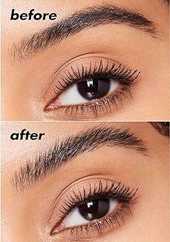 Brow lift